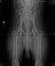 OFA Hip X-ray