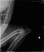 Right Elbow X-ray